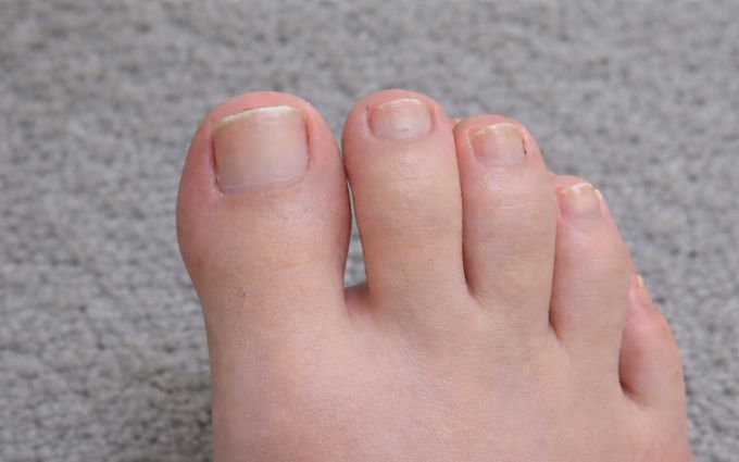 The NailScience 2-Step Nail Restoration Kit