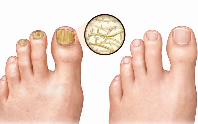 Woman relaxing outdoors