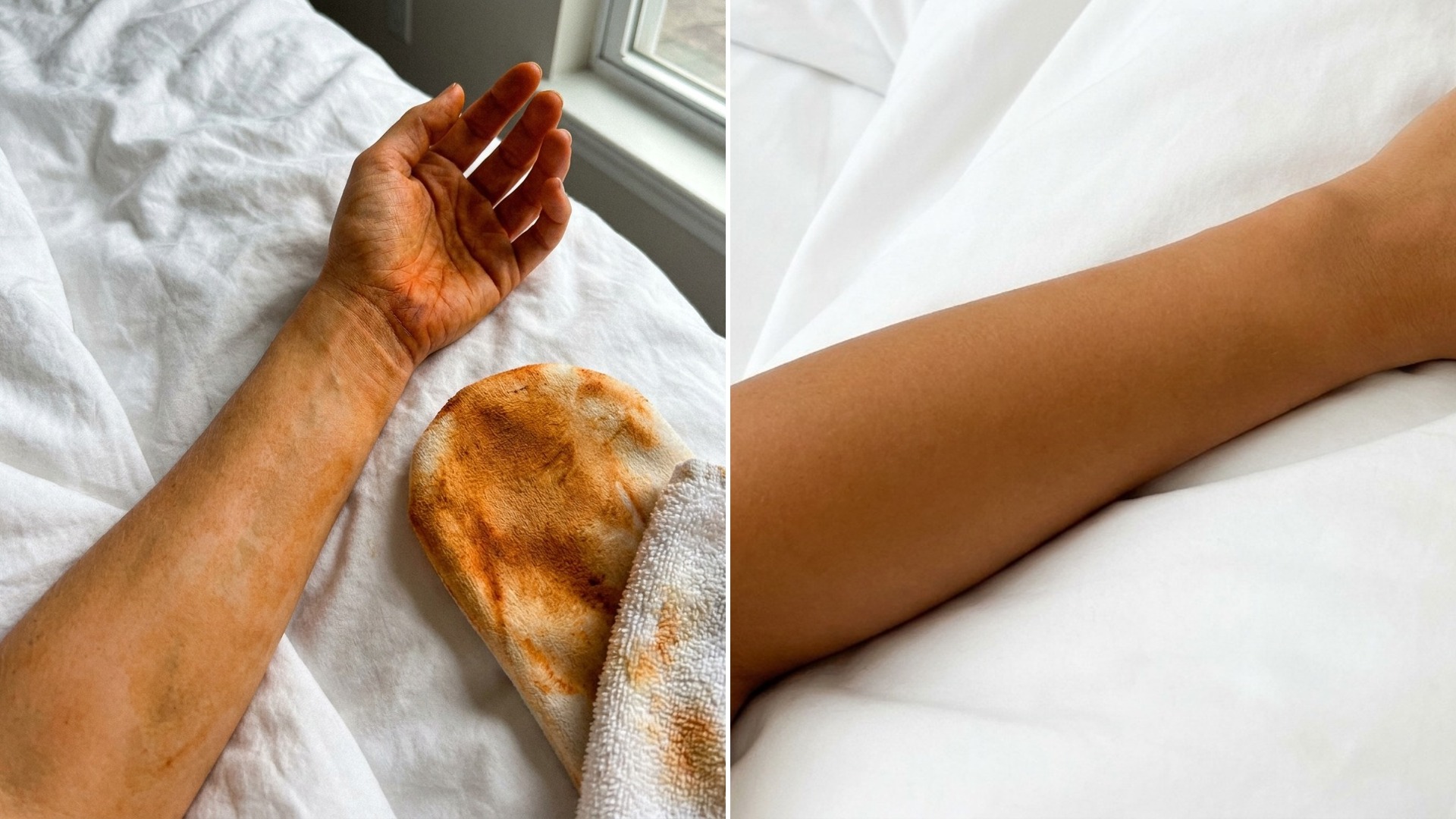 Side-by-side: streaky, stained DHA self-tan vs an even golden carotenoid glow built from the inside